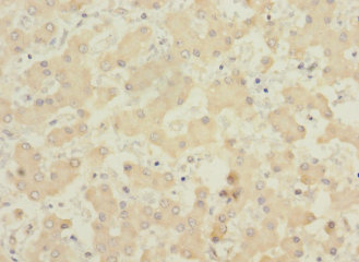 Immunohistochemistry of paraffin-embedded human liver tissue using PIGL Polyclonal Antibody at dilution 1:100