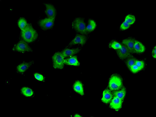 ATP6V0A2 Polyclonal Antibody