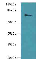 CAPN6 Polyclonal Antibody