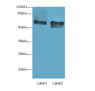 CNOT2 Polyclonal Antibody