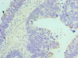 Immunohistochemistry of paraffin-embedded human ovary at dilution 1:100