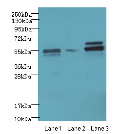 AKT1 Polyclonal Antibody