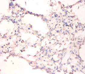 Immunohistochemistry of paraffin-embedded human lungs at dilution of 1:100