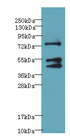 FOXP1 Polyclonal Antibody