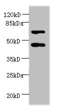 Western blot<br />All lanes: HDAC3 Polyclonal Antibody at 2ug/ml+Hela cells<br />Secondary<br />Goat polyclonal to rabbit at 1/10000 dilution<br />Predicted band size: 49, 50 kDa<br />Observed band size: 49 kDa<br />