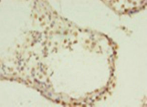 Immunohistochemistry of paraffin-embedded human testis using HIST1H2AG Polyclonal Antibody at dilution 1:100