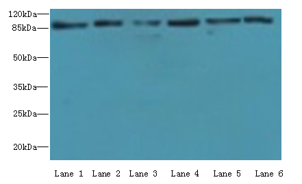 MCM3 Polyclonal Antibody