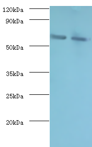 NELFB Polyclonal Antibody