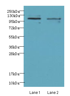 NFKB1 Polyclonal Antibody