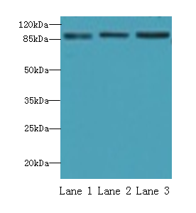 STAT5B Polyclonal Antibody