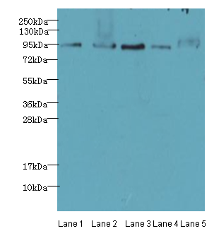 THOC1 Polyclonal Antibody