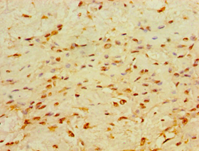 CHD1 Polyclonal Antibody