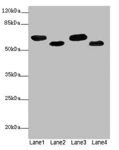 ESR1 Polyclonal Antibody