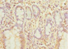 Immunohistochemistry of paraffin-embedded human small intestine tissue at dilution 1:100