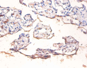 RELA Polyclonal Antibody