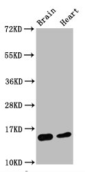 Histone H3.1K4me2 (H3.1K4 Dimethyl) Monoclonal Antibody [RMC418A] (100 µl)