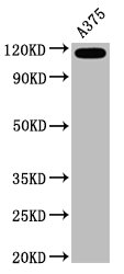 CD146 Monoclonal Antibody [RMC563A]