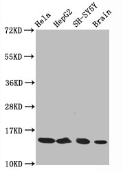 Histone H3.1K14ac (Acetyl H3.1K14) Monoclonal Antibody [RMC418C]