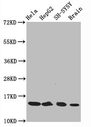 Histone H3.1K14ac (Acetyl H3.1K14) Monoclonal Antibody [RMC418C] (100 µl)