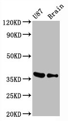 GAPDH Monoclonal Antibody  [RMC232A]
