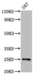 CD9 Monoclonal Antibody [RMC969A]