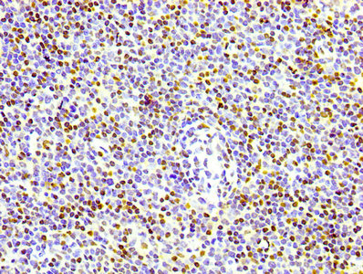Phospho Histone H1.4 (T17) Monoclonal Antibody [RMC380A]