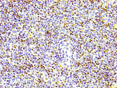 Phospho Histone H1.4 (T17) Monoclonal Antibody [RMC380A] (50 µl)