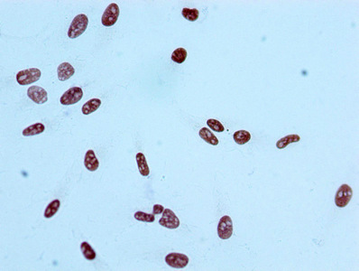 Immunocytochemistry analysis of Histone H2AB/EK9ac (Acetyl H2AB/EK9) Monoclonal Antibody [RMC385A] diluted at 1:100 and staining in Hela cells performed on a Leica BondTM system.