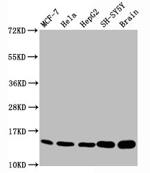Histone H3.1K18me1 (H3.1K18 Monomethyl) Monoclonal Antibody [RMC418J]