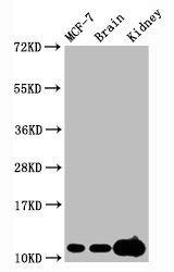 Histone H4K20me3 (H4K20 Trimethyl) Monoclonal Antibody [RMC429D]