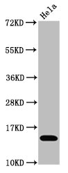 Histone H3.1K4ac (Acetyl H3.1K4) Monoclonal Antibody [RMC418K]