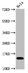 Histone H3.1K4ac (Acetyl H3.1K4) Monoclonal Antibody [RMC418K]