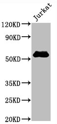 CD4 Monoclonal Antibody  [RMC935A]