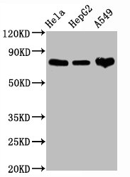 CD44 Monoclonal Antibody [RMC938A]