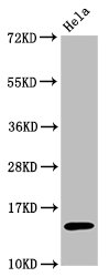 Histone H3.1K56ac (Acetyl H3.1K56) Monoclonal Antibody [RMC418L]