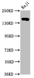 CD21 Monoclonal Antibody [RMC934A]
