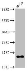 Histone H2BBK20ac (Acetyl H2BBK20) Monoclonal Antibody [RMC402A]