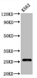 CD81 Monoclonal Antibody [RMC960A] (100 µl)