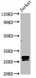 CD99 Monoclonal Antibody [RMC973A]