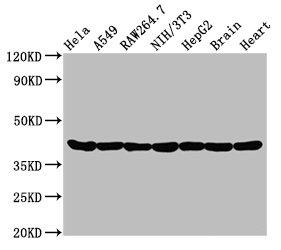 ACTA1 Monoclonal Antibody [RMC205A]