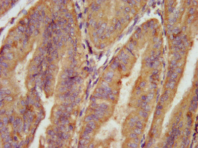 AARS Polyclonal Antibody