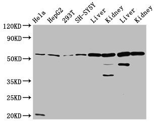 ALDH7A1 Polyclonal Antibody