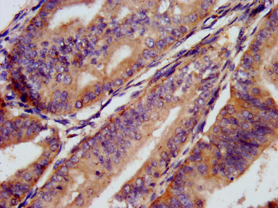 CD1E Polyclonal Antibody