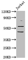 CHRNB2 Polyclonal Antibody