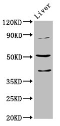 CHRNB3 Polyclonal Antibody