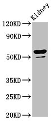 CYP8B1 Polyclonal Antibody