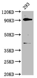 DHX15 Polyclonal Antibody