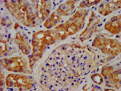 GHRHR Polyclonal Antibody