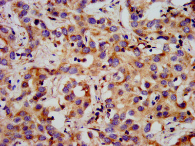 GPR1 Polyclonal Antibody