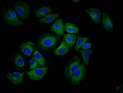 HAS1 Polyclonal Antibody